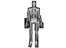 Menselijk lichaam - rontgenfoto's - skelet - geraamte - transparante film - per set